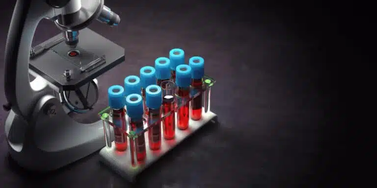 STD test in the laboratory room