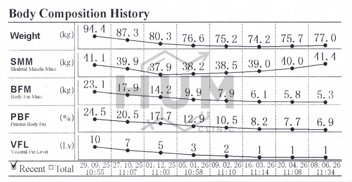 InBody body composition chart of a 32-year-old male on Mounjaro (tirzepatide) at H.U.M. Clinic Bangkok: over six months, weight fell from 94.4 kg to 77.0 kg and body fat mass from 23.1 kg to 5.3 kg, while skeletal muscle was preserved (41.1 kg to 41.4 kg) and visceral fat dropped from level 10 to 1.