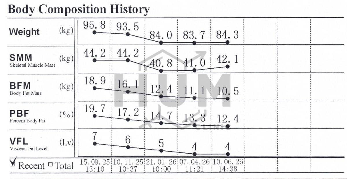 InBody body composition chart of a 47-year-old male on Mounjaro (tirzepatide) at H.U.M. Clinic Bangkok: over nine months, body fat mass dropped from 18.9 kg to 10.5 kg and weight from 95.8 kg to 84.3 kg, with skeletal muscle largely maintained and visceral fat reduced from level 7 to 4.