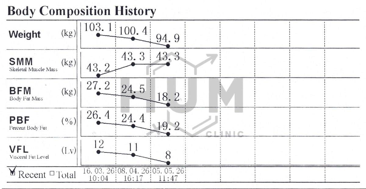 InBody body composition chart of a 54-year-old male on Mounjaro (tirzepatide) at H.U.M. Clinic Bangkok: in seven weeks, body fat mass fell from 27.2 kg to 18.2 kg and weight from 103.1 kg to 94.9 kg, with skeletal muscle held at 43 kg and visceral fat down from level 12 to 8.