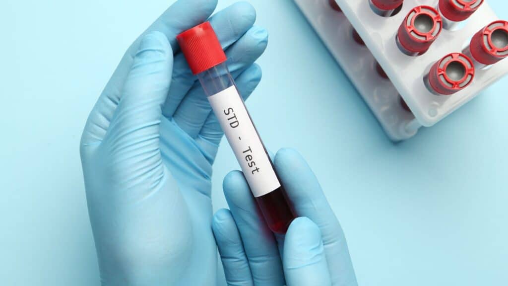 Do I Really Need an STD Test