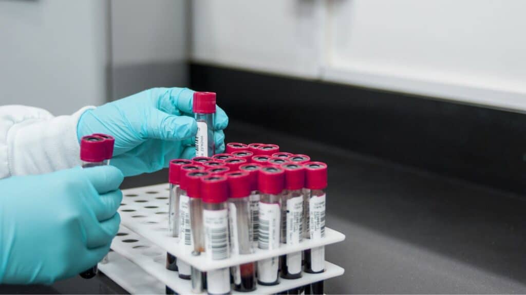 What STDs Should You Test For Regularly?