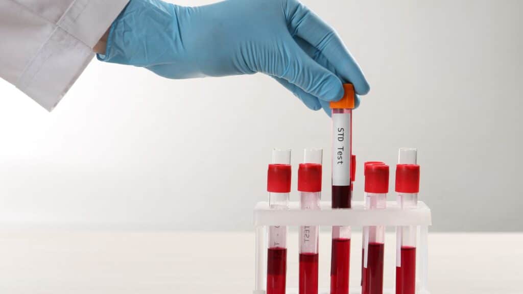 How to Choose the Right STD Clinic in Bangkok