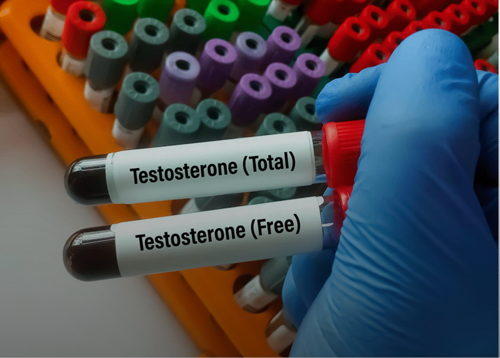 Blood sample tubes labeled Testosterone Total and Free ready for testing testosterone levels.
