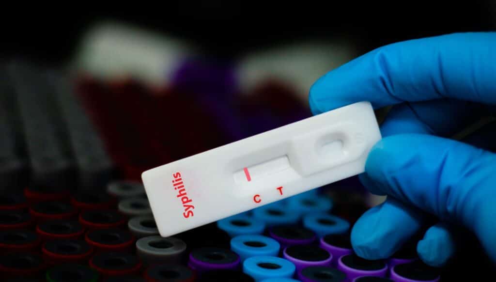 A syphilis test