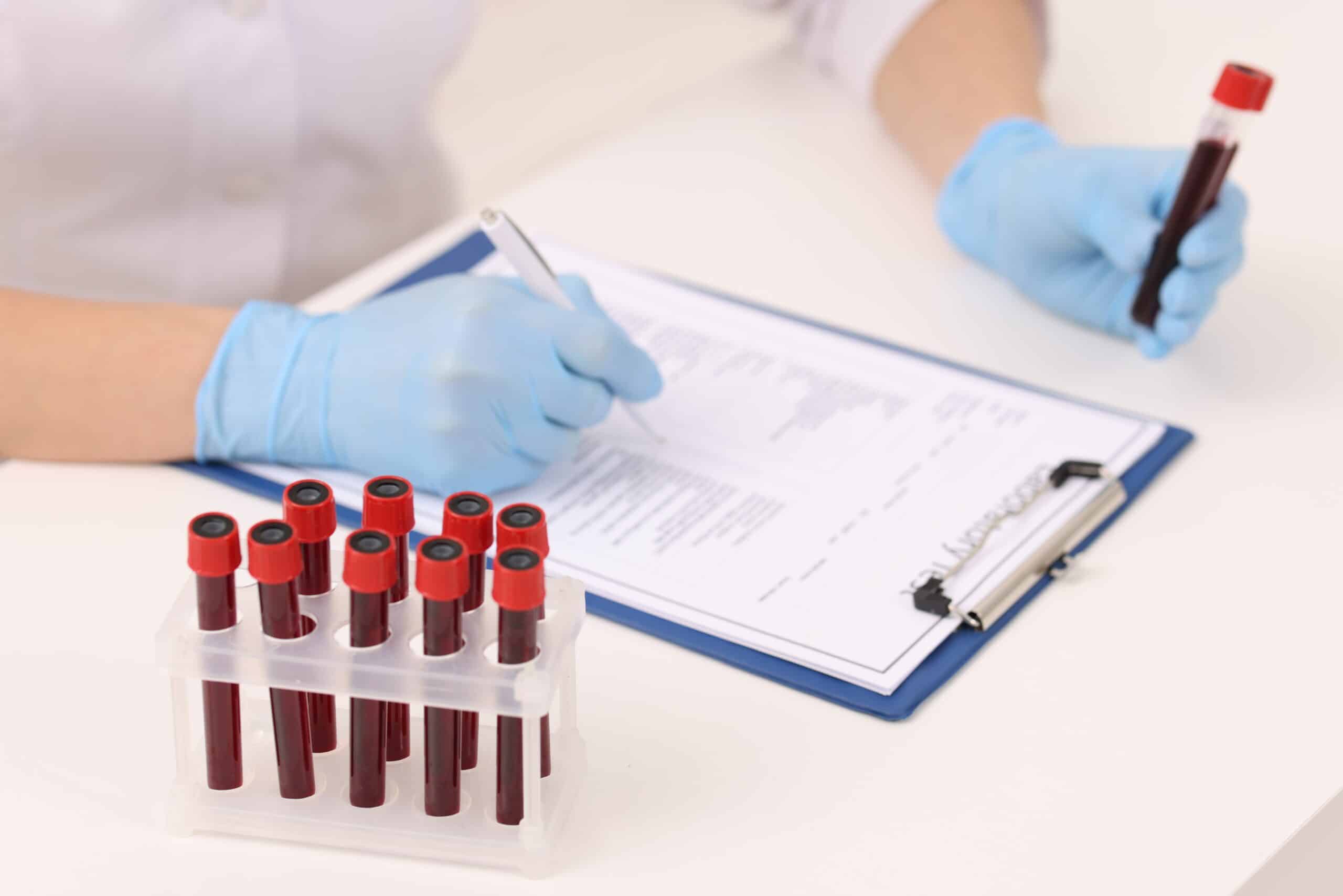 Blood sample tubes and laboratory paperwork being reviewed by a clinician.