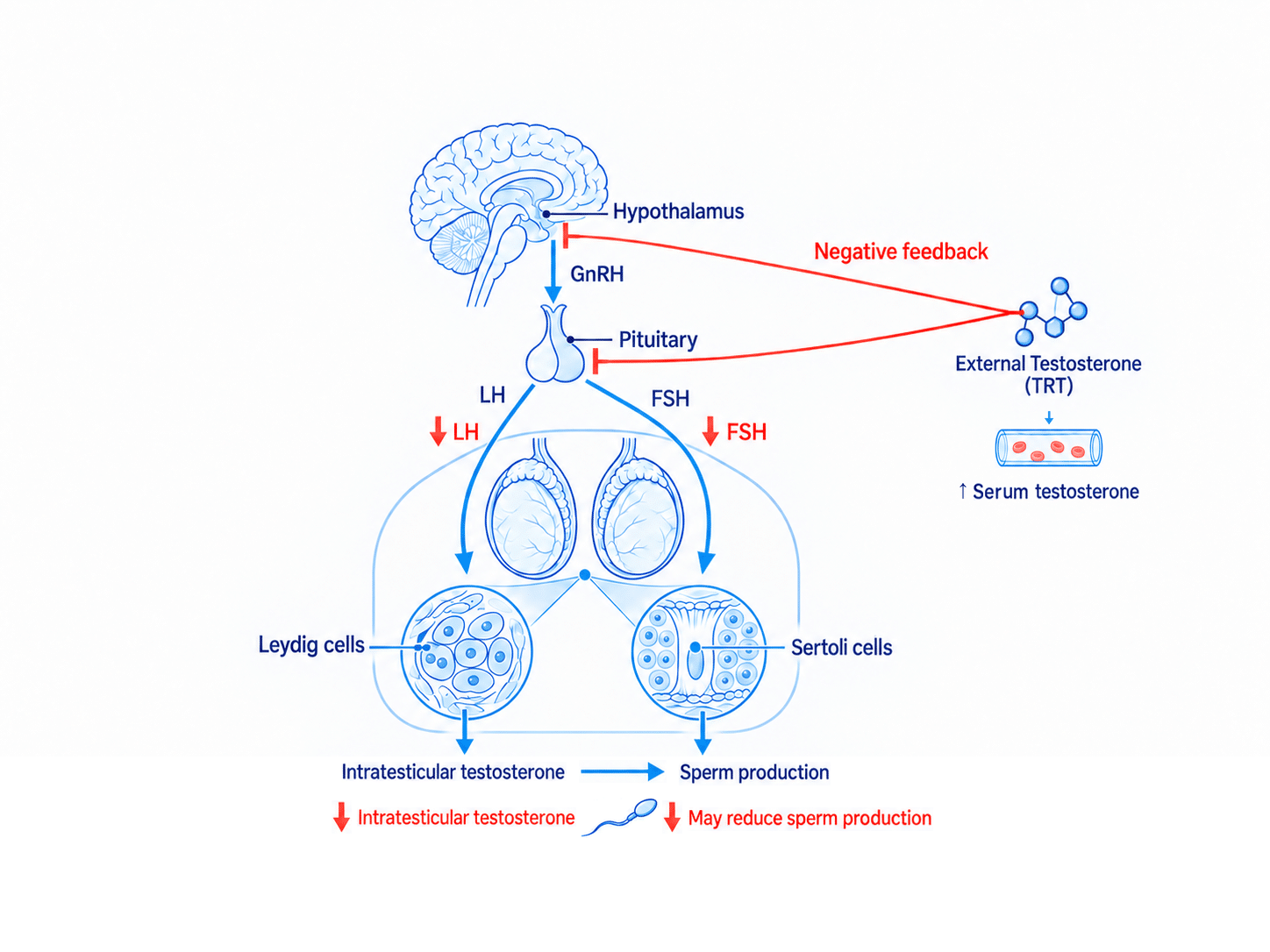 Diagram showing how external testosterone raises serum testosterone while suppressing LH and FSH, lowering intratesticular testosterone and potentially reducing sperm production.
